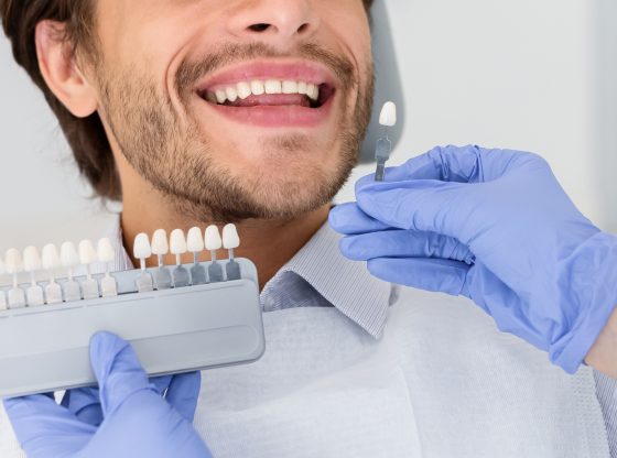 Zabieg wybielania zębów
